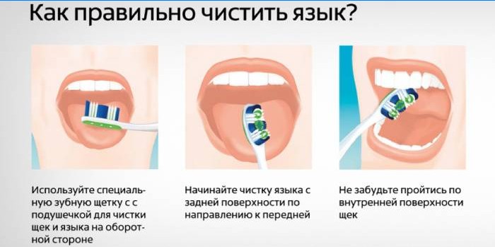 Hogyan tisztítsuk meg a nyelved?